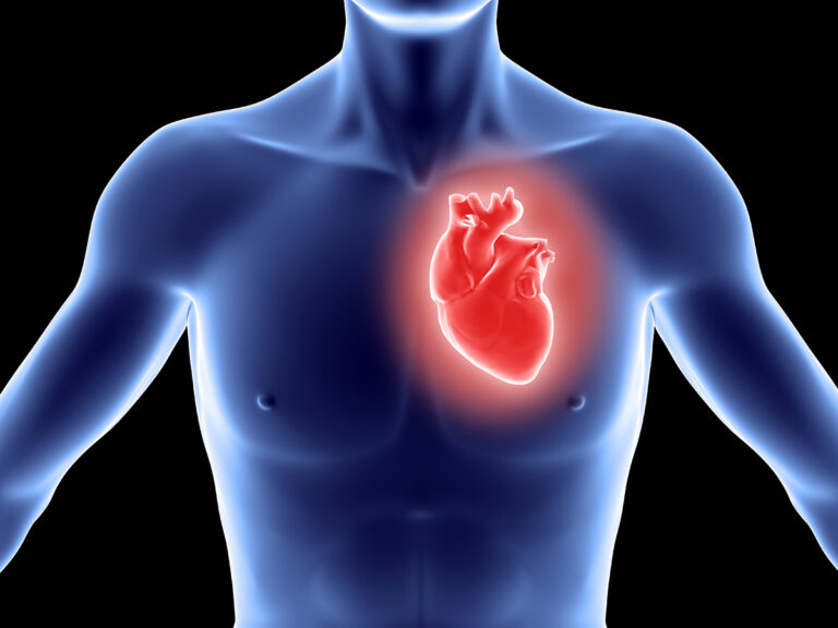 Скажем нет инфаркту миокарда!